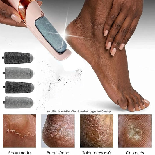 Lime à Pied Électrique – Éliminez Facilement les Callosités et les Peaux Mortes, Puis Retrouvez des Pieds Doux et Lisses en Quelques Minutes, Sans Quitter Votre Maison.